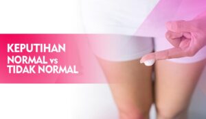Perbedaan Keputihan Normal dan Tidak Normal