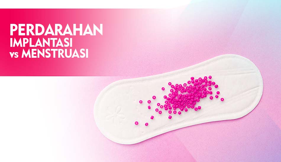 Perbedaan Perdarahan Implantasi dan Menstruasi
